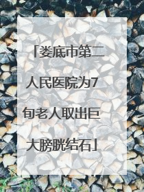 娄底市第二人民医院为7旬老人取出巨大膀胱结石